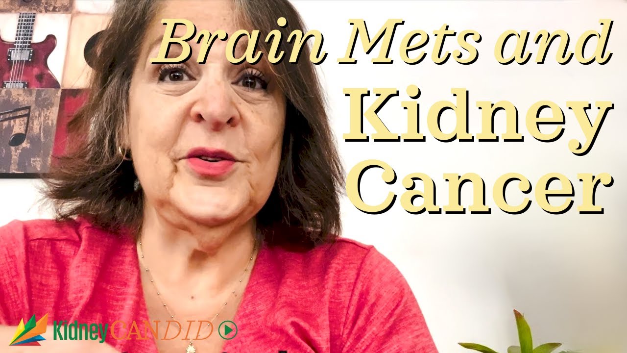 Living with Stage IV Kidney Cancer: Meryl's Journey with Brain Metastases and SRT Treatment