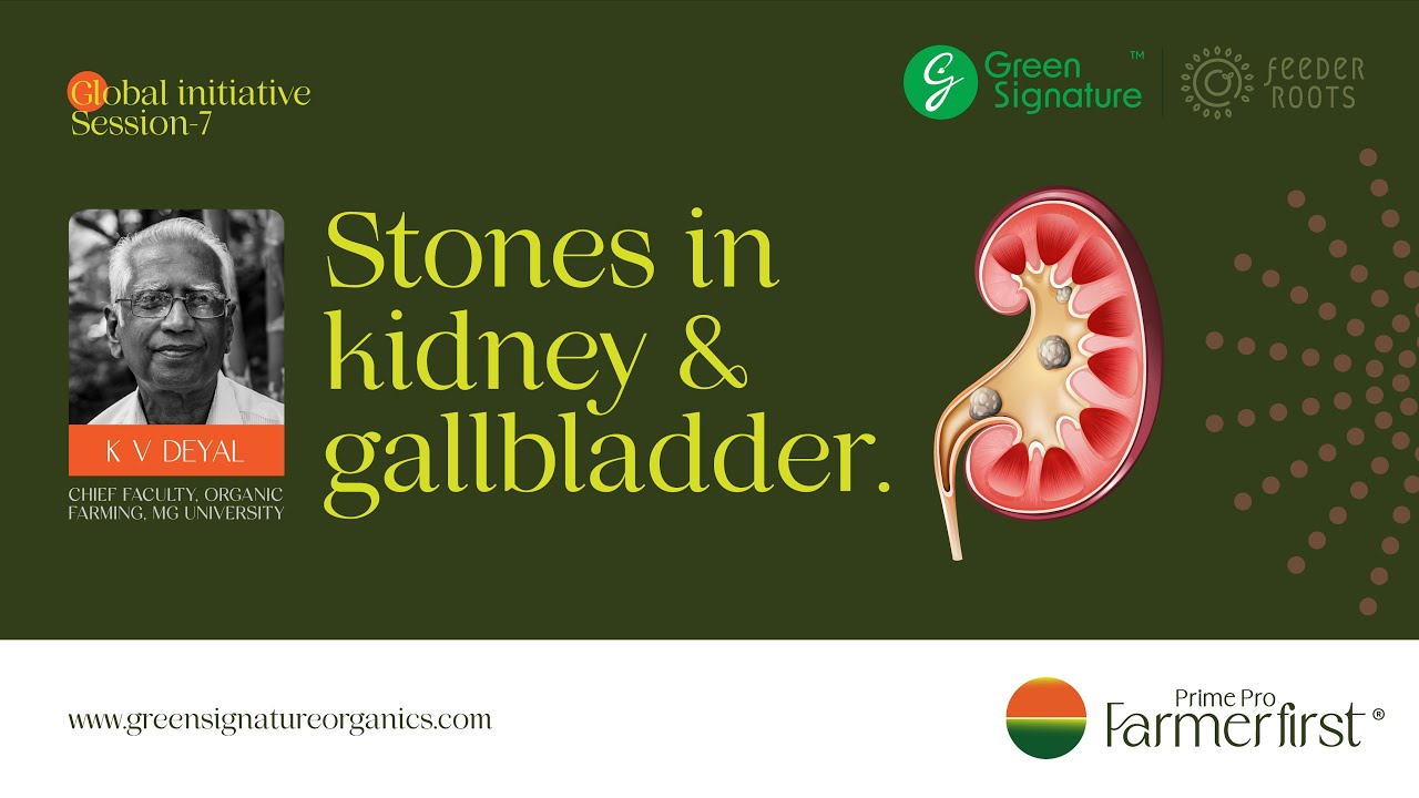 Stones in #kidney  & #gallbladder