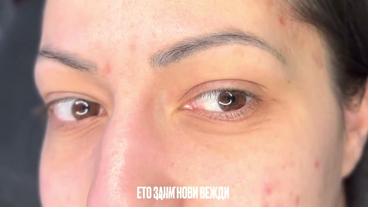 Премахване на перманентен грим - траен татус и изграждане на нови вежди с Микропигментация
