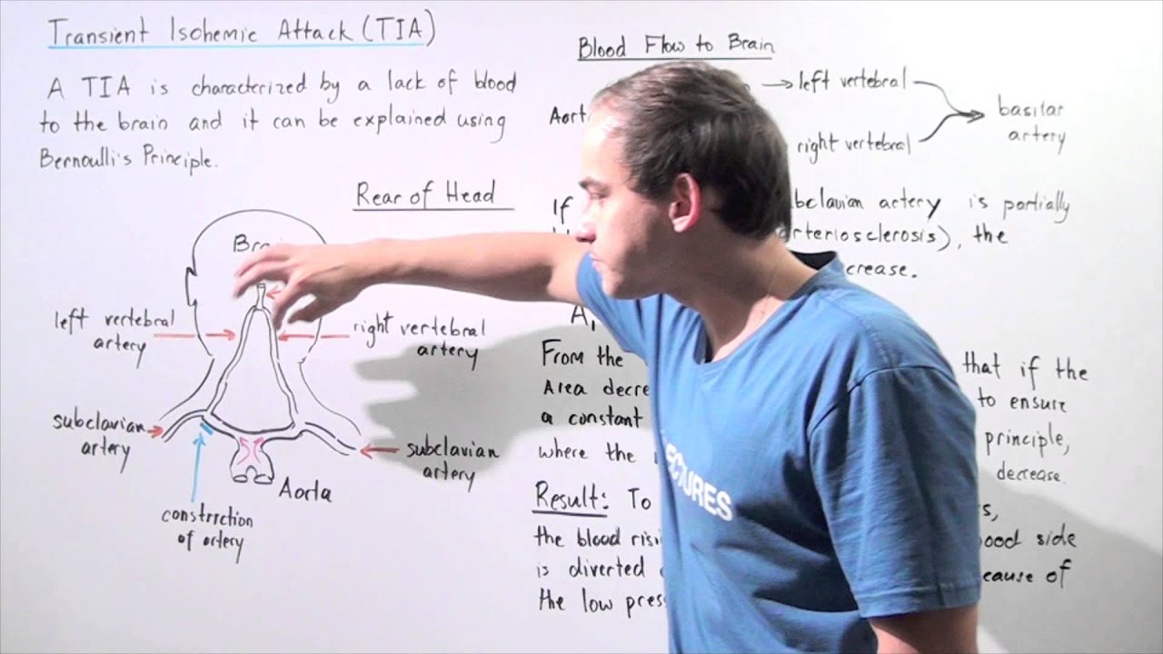 Transient Ischemic Attack and Bernoulli's Principle