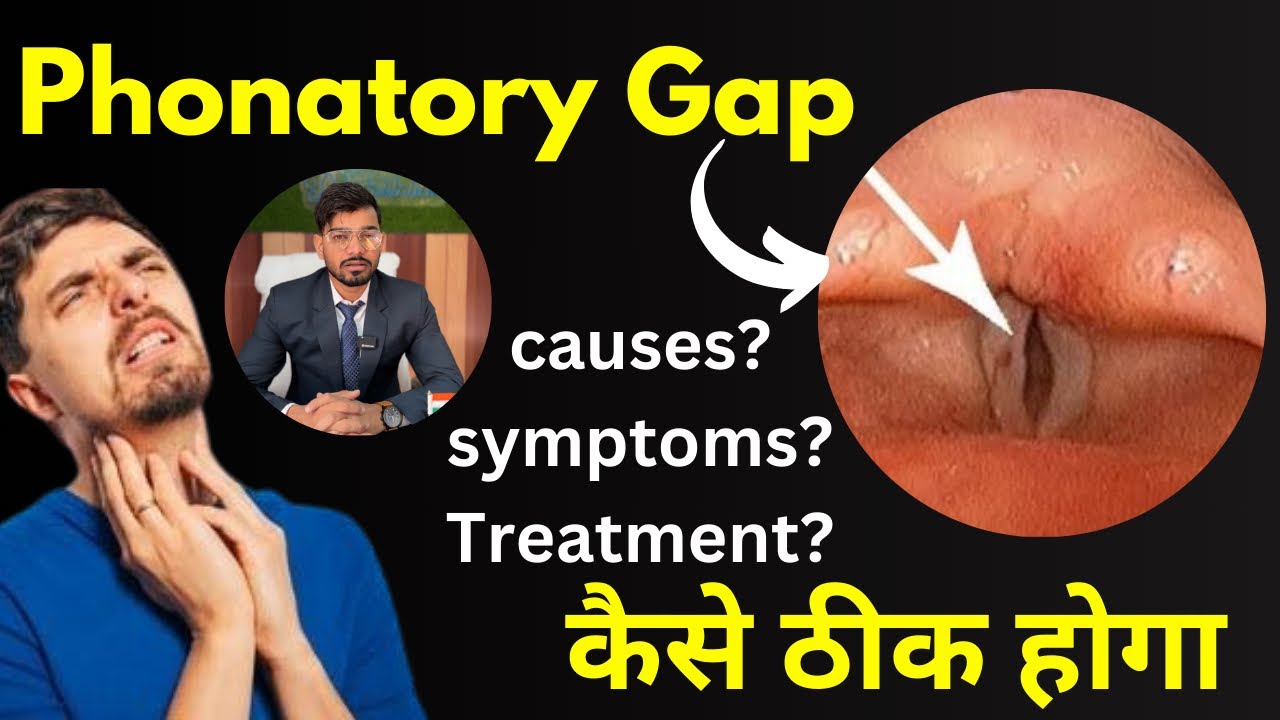 आवाज बहुत ज़्यादा ख़राब है तो देखे ये वीडियो #Phonatorygap