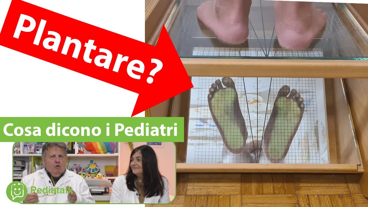 PIEDE PIATTO del bambino: serve il plantare? Cosa dicono i Pediatri.