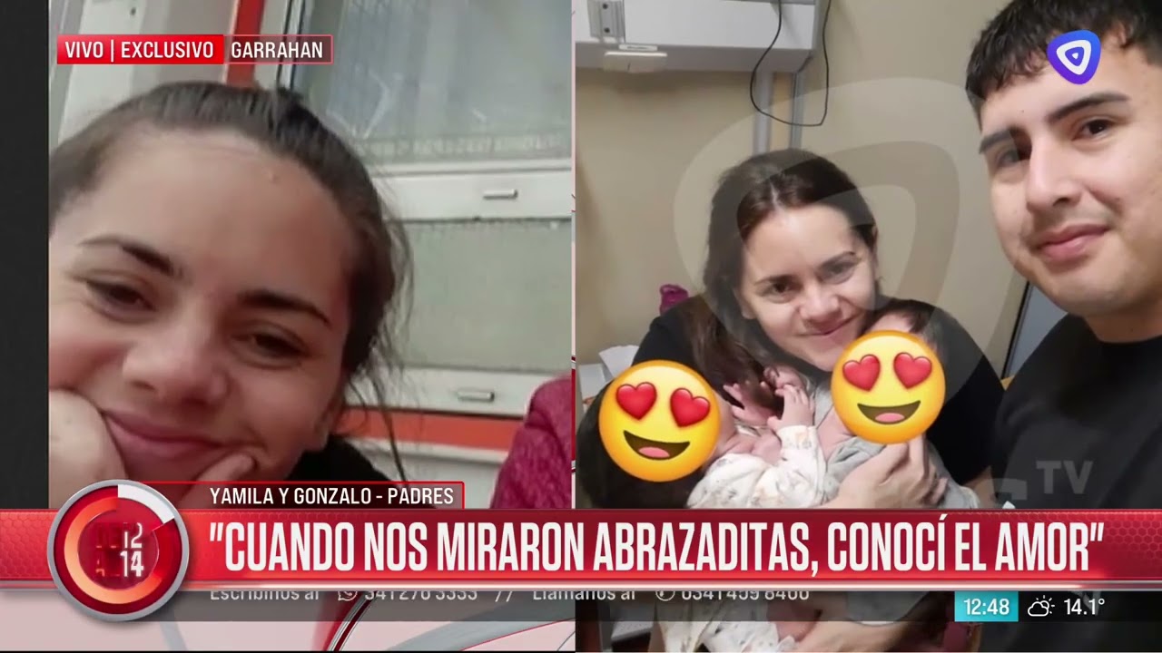 Siamesas rosarinas separadas con éxito en el Garrahan