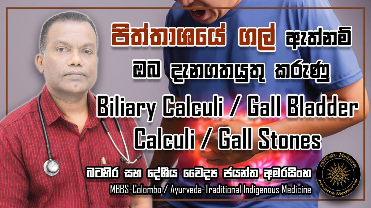 පිත්තාශයේ ගල් ඇත්නම් ඔබ දැනගතයුතු කරුණු | Biliary Calculi / Gall Bladder Calculi / Gall Stones