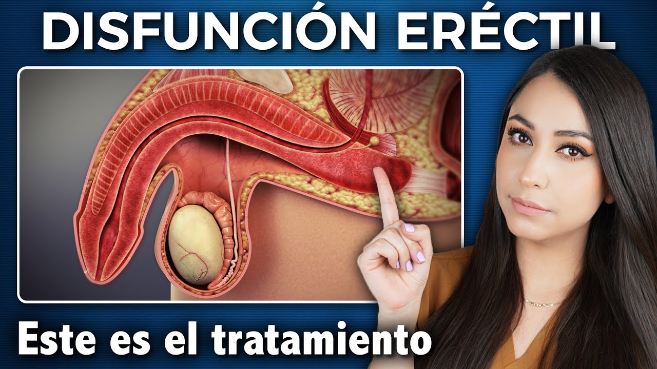 DISFUNCIÓN ERÉCTIL: causas, síntomas y CÓMO SE TRATA paso a paso 👩🏻‍⚕️ @Dra. Pau Zúñiga