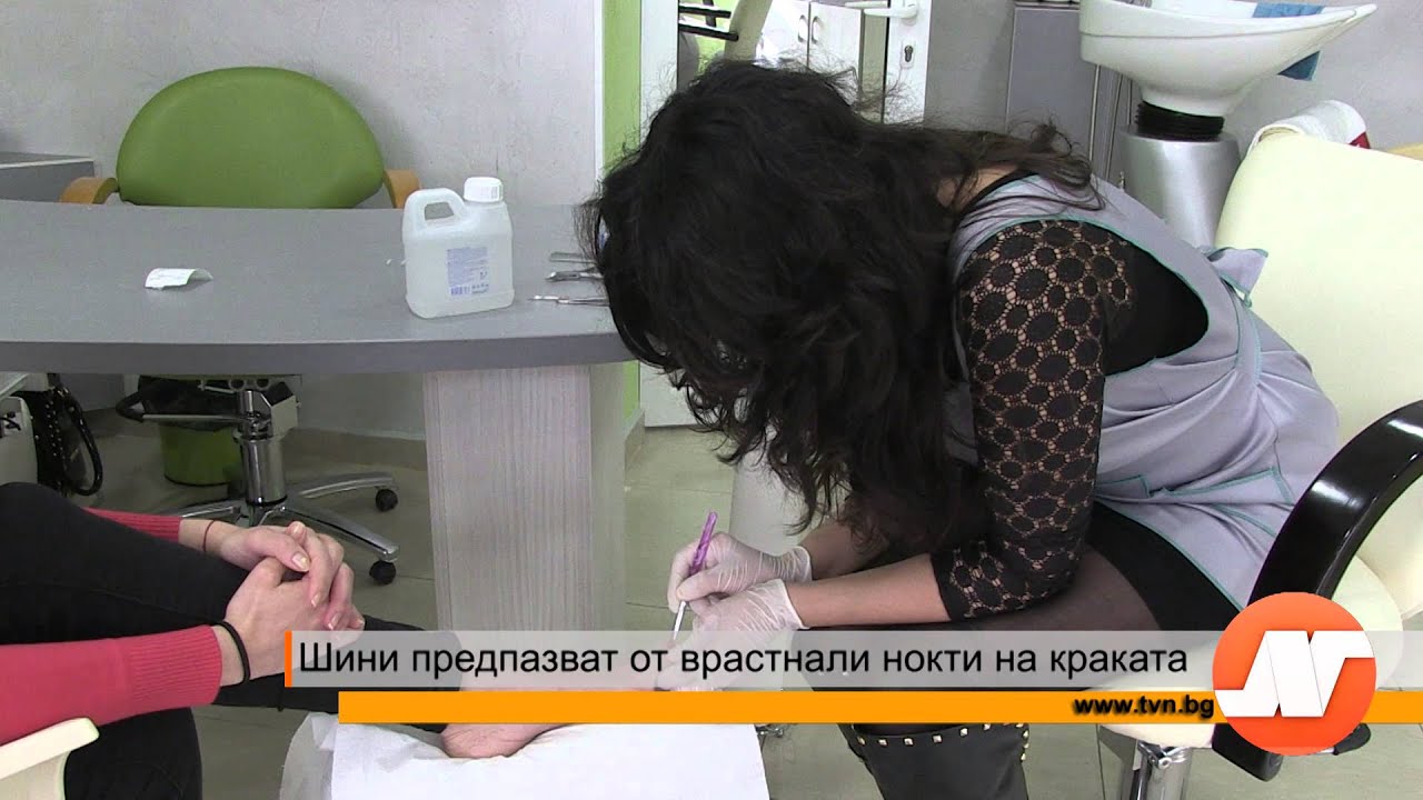 Шини предпазват от врастнали нокти на краката