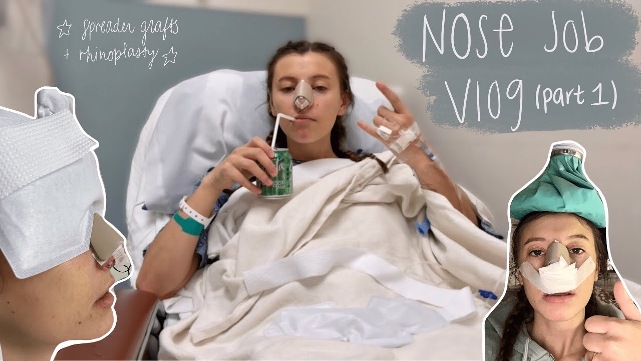 NOSE JOB VLOG part 1: surgery day, pre-op, + my *very real* experience under anesthesia