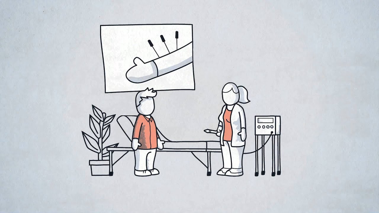 Stoppen met roken in 85 seconden - Prostop lasertherapie