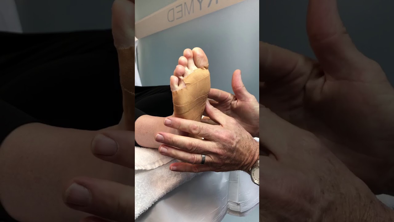 Foot strapping by Christchurch Podiatrist - Bruce Baxter