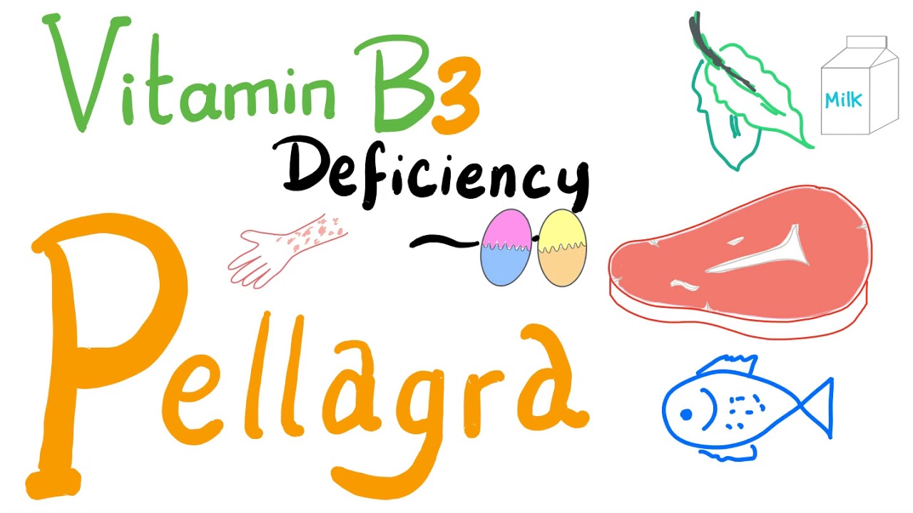 Pellagra (Vitamin B3 Deficiency) - NAD+, NADH, Nicotinic Acid - Diet & Nutrition