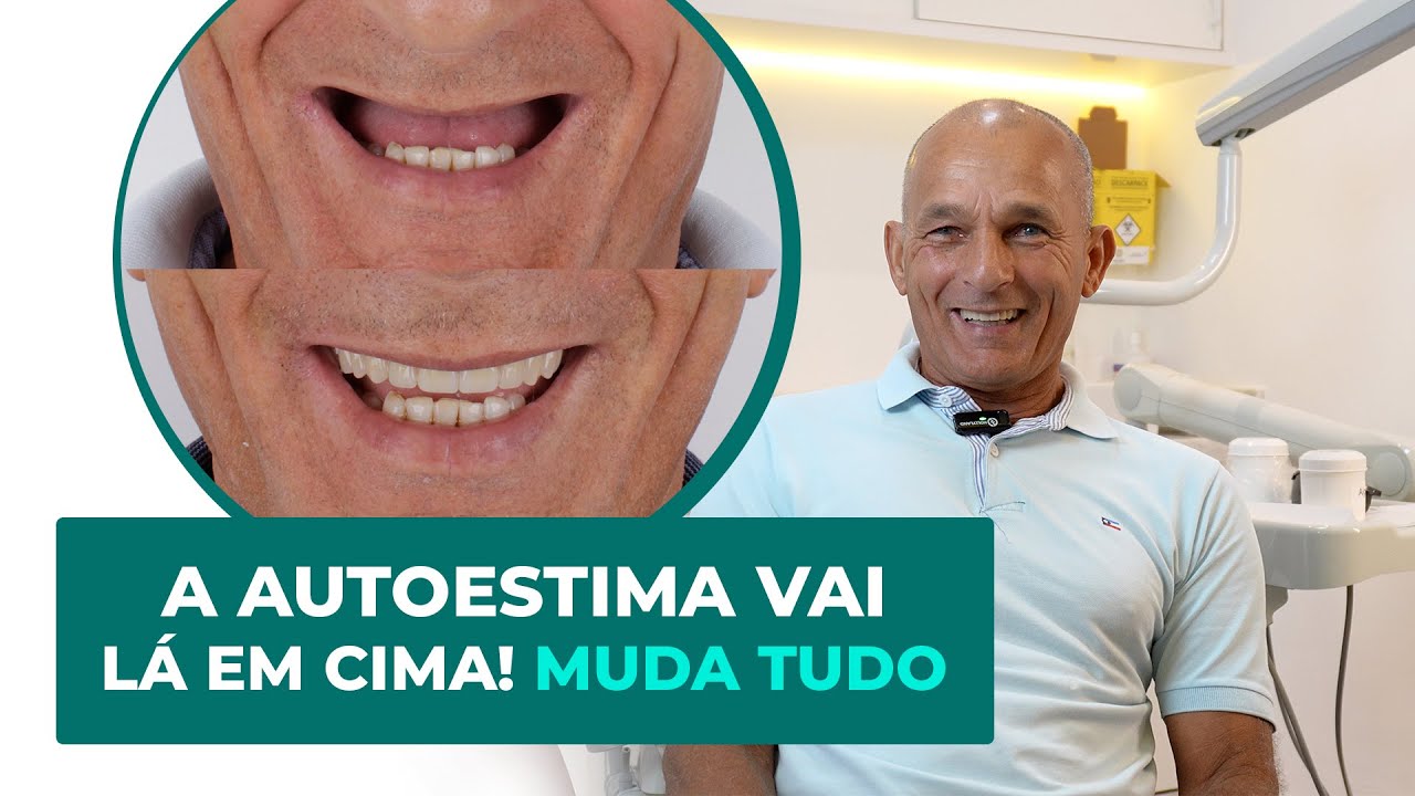 Nunca é Tarde Para Sorrir: A História Real do Luiz - Prótese Protocolo - Heal Odontologia