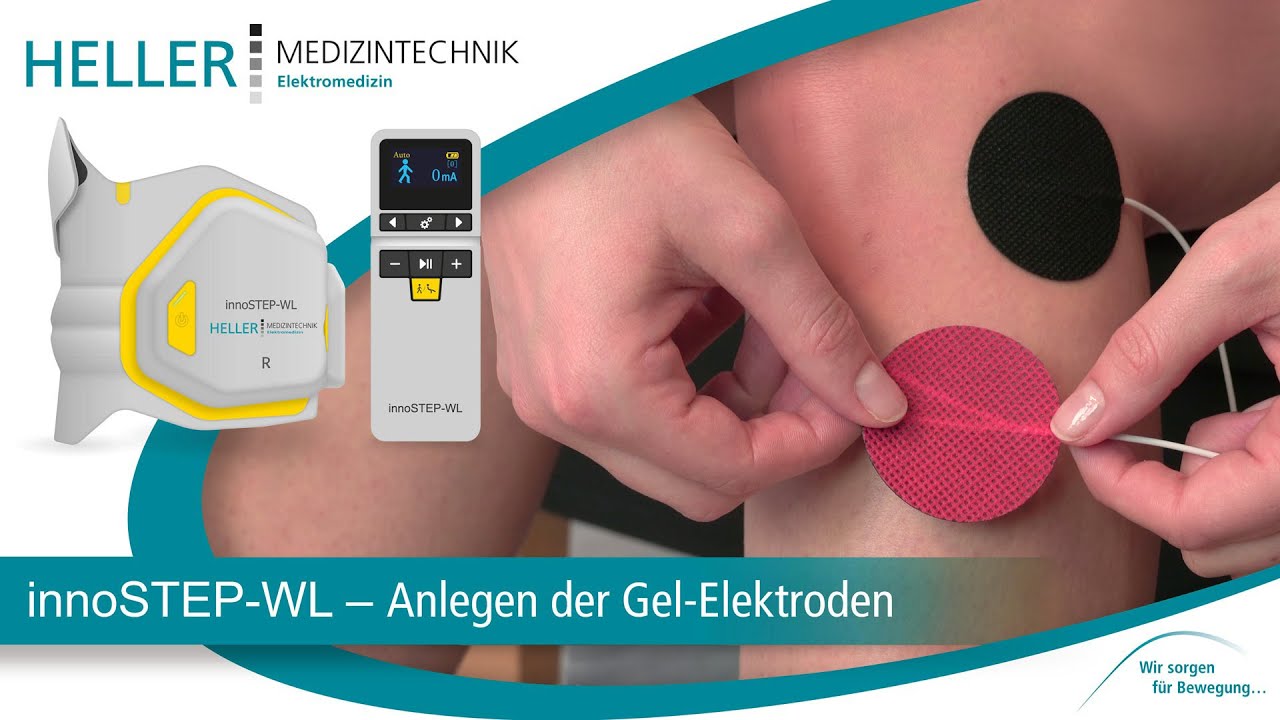 Kabelloses Fußhebersystem innoSTEP-WL bei Fußheberschwäche: Verwendung der Gel-Elektroden