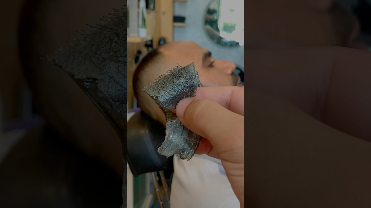 The Wax Doesn&rsquo;t Spare &ndash; Cheek Hair Removal in Action! #shorts