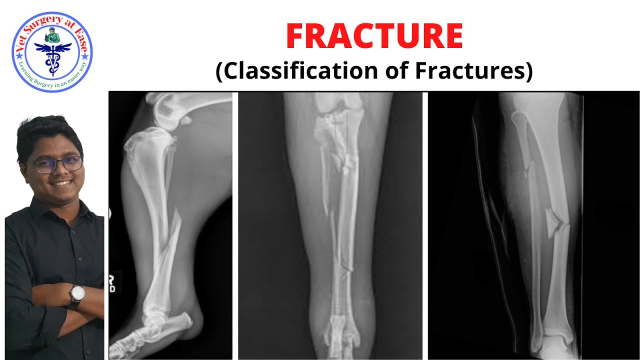 FRACTURE (Classification) | Lecture 02 I Orthopedics