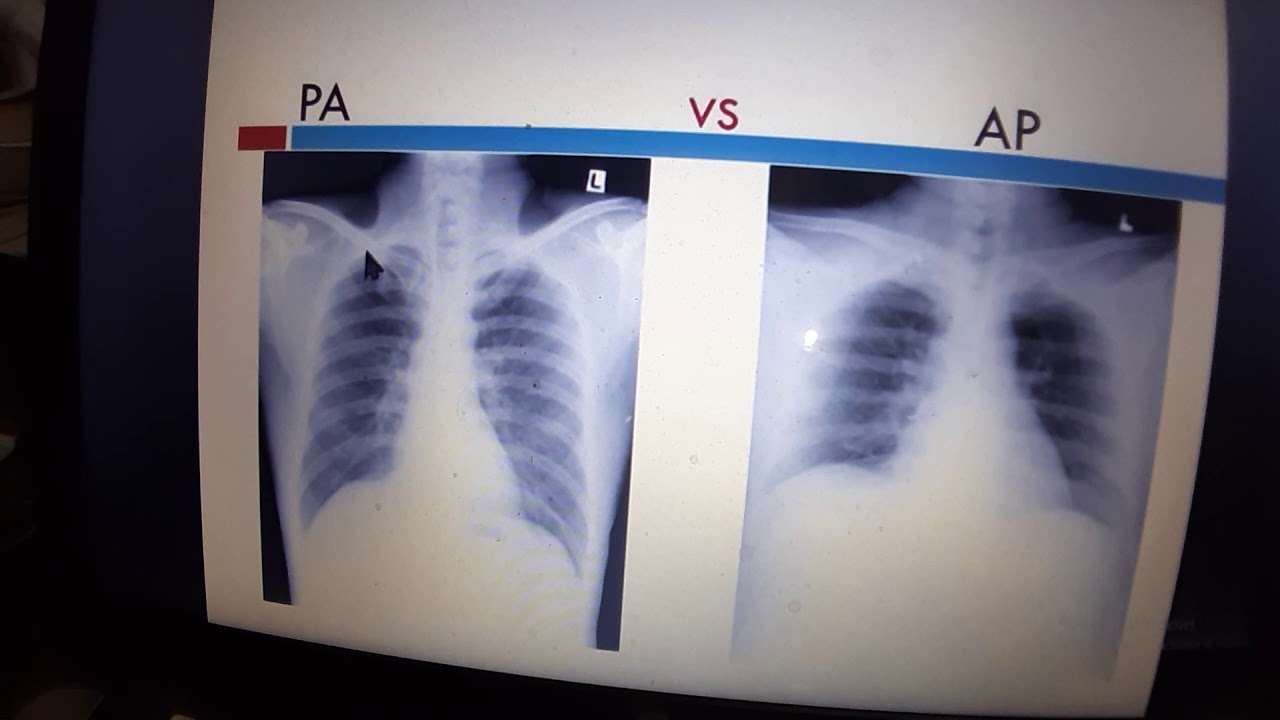 VIVA questions regarding X-ray film