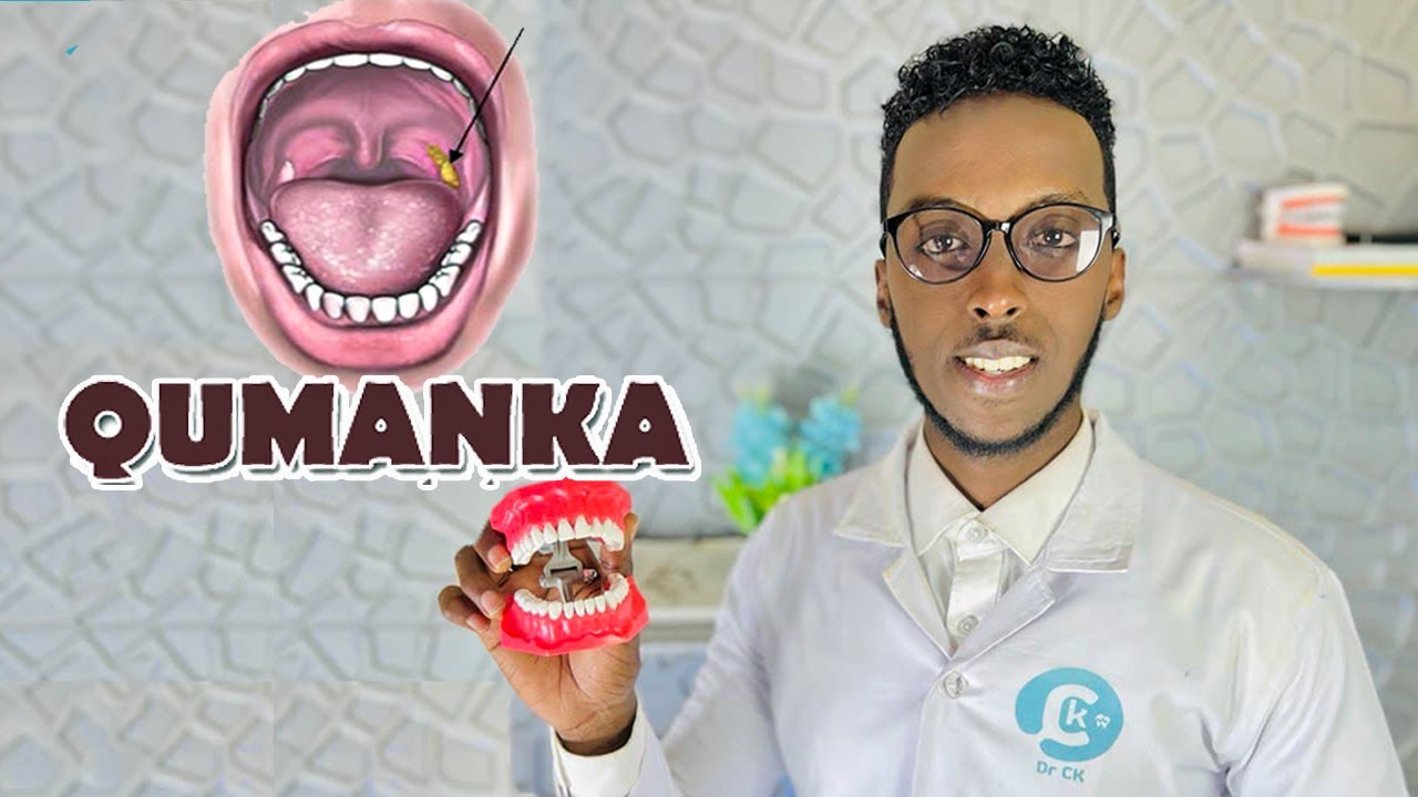 CAABUQA QUMANKA IYO SIDA LOO DAWEEYO