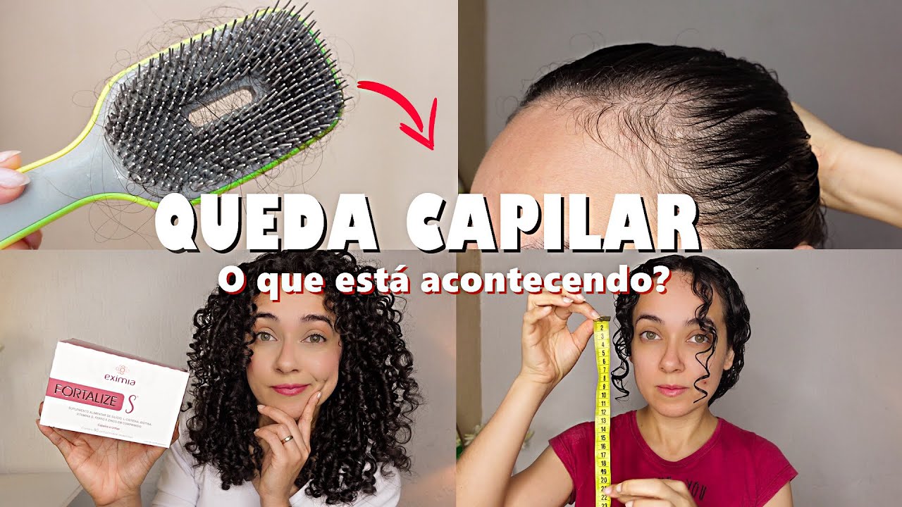 CABELO CAINDO NOVAMENTE, CAUSA E SUPLEMENTO ALIMENTAR FORTALIZE S | Oeslanhiny Nunes
