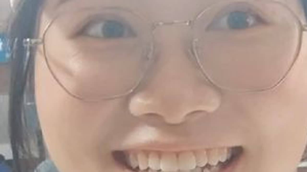 关于我拔了一颗阻生智齿，第四天就没有牙齿可以吃饭了的故事#生活vlog日常记录   #拔智齿 #拔牙记 #拔牙是种什么体验