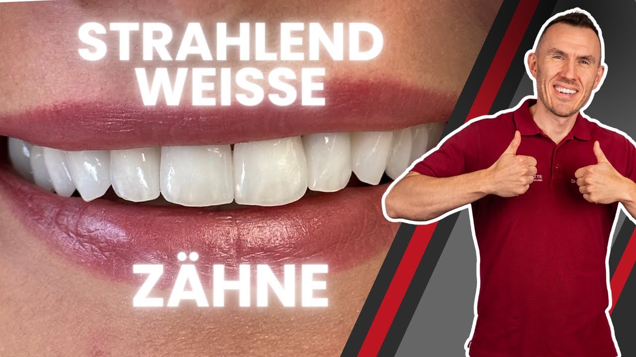 Mega Hollywood Smile! Schöne weisse Zähne mit neuen Zahnkronen und Brücken in Bleach 3/BL3!