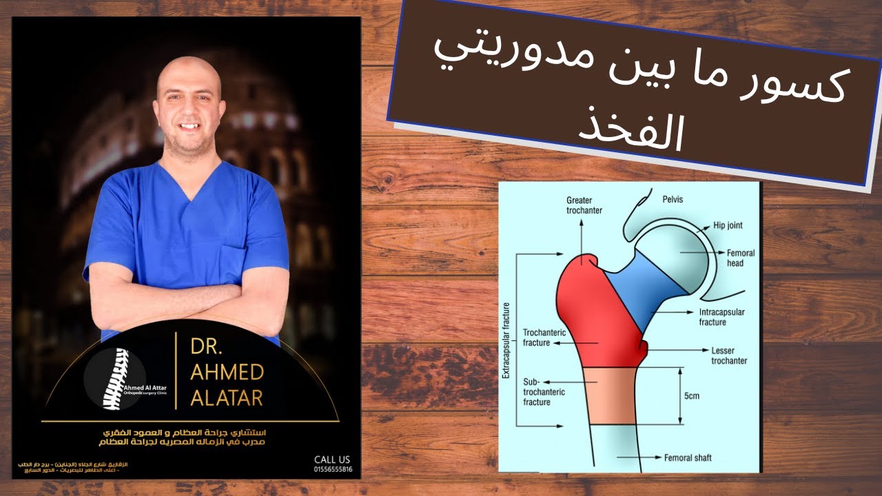 كسور ما بين مدوريتي الفخذ - طرق التفكير في العلاج للدكتور احمد العطار