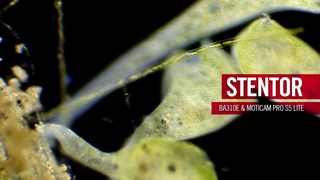 Stentors, some of the largest single celled organisms in the world | by Motic Europe