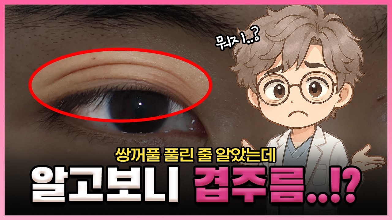쌍꺼풀이 위아래로 겹쳐 보인다면..!? 그것은 겹주름!😟