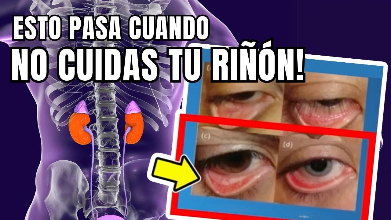 ¡Alerta! 5 signos de que tus riñones están débiles y necesitas atenderlos.