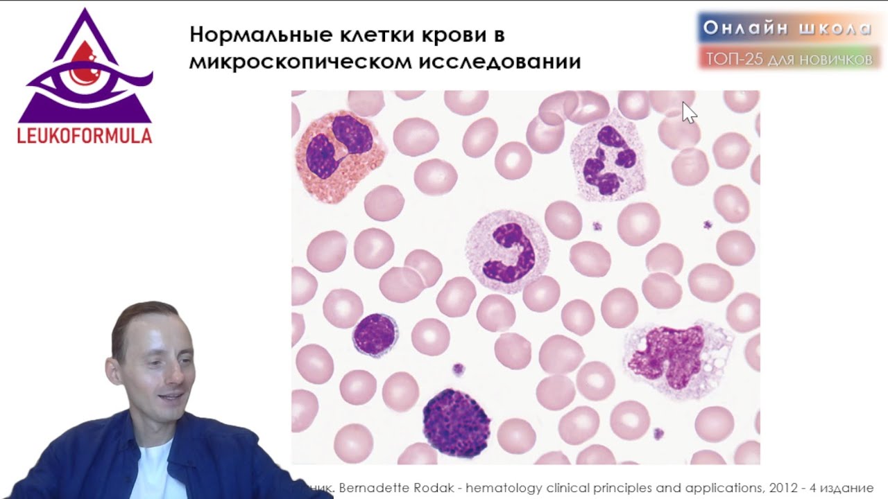 Ключевые 30 снимков крови и костного мозга. Практикум по гематологической морфологии.
