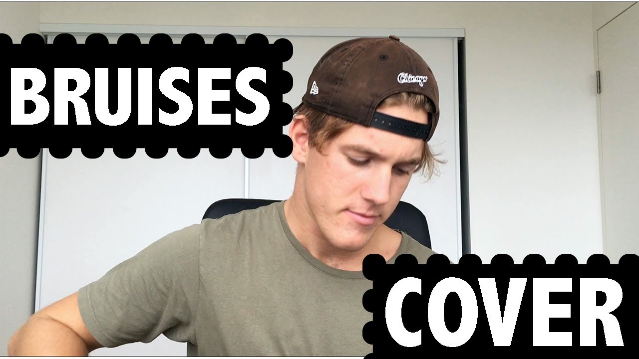 BRUISES - LEWIS CAPALDI (Mitch Blake Cover)