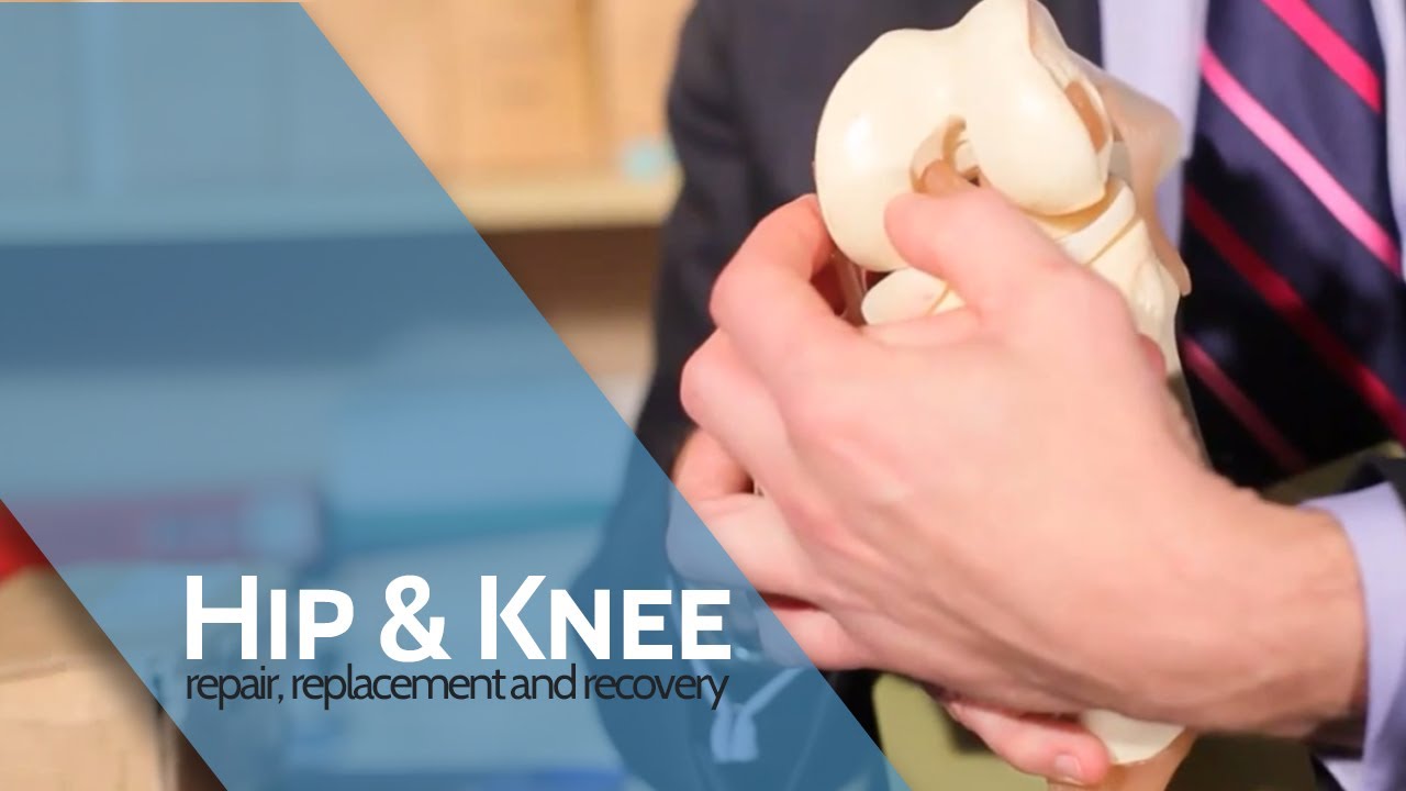 Risks of Arthroscopy | Arthroscopy