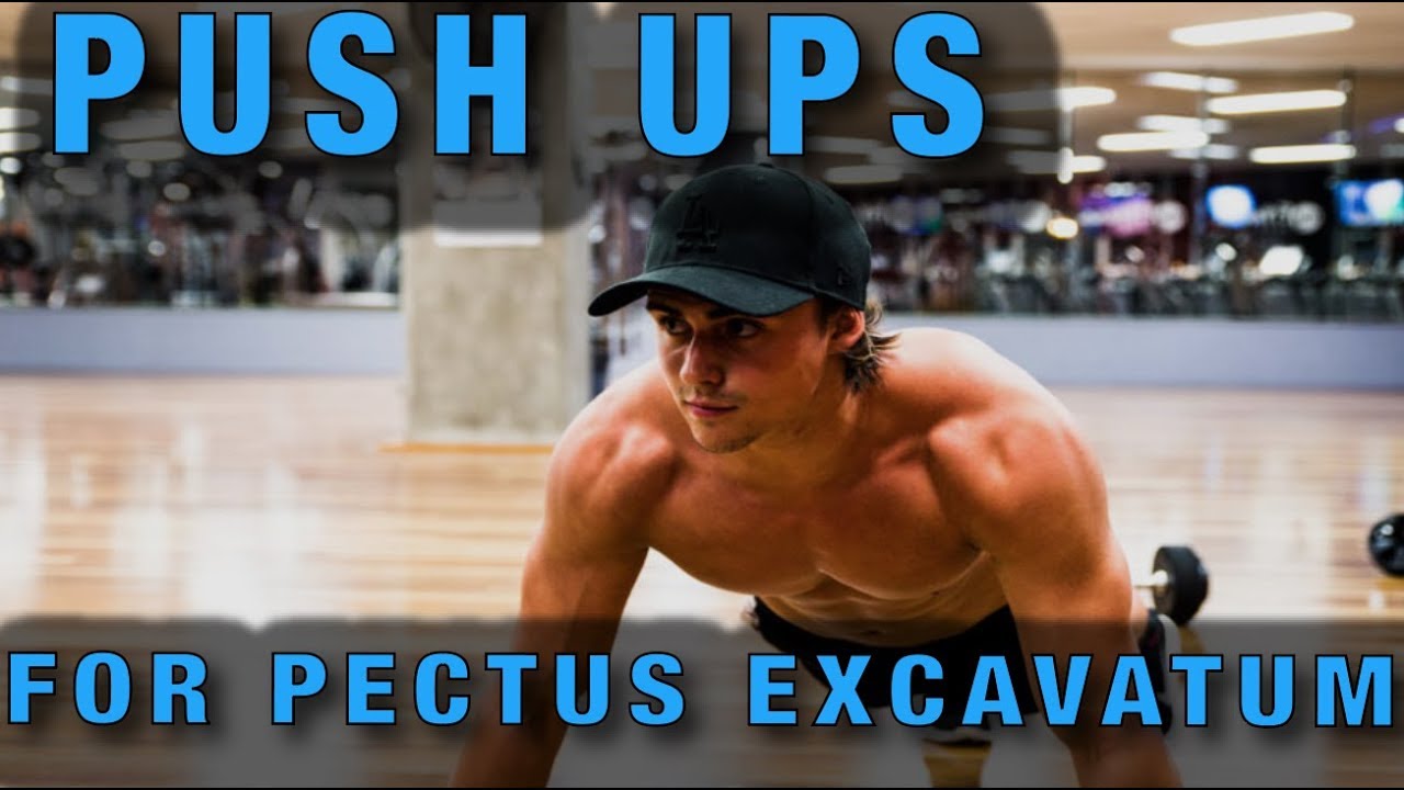 Push ups for Pectus Excavatum