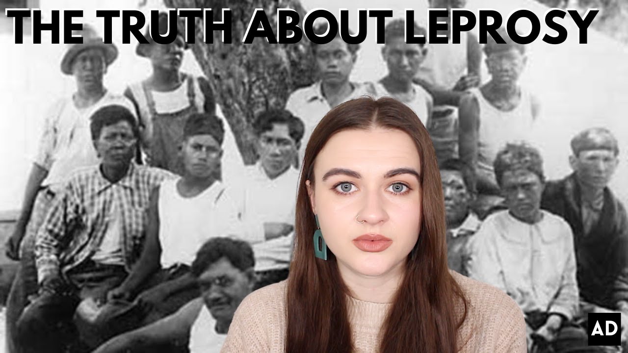 THE TRUTH ABOUT LEPROSY | A HISTORY SERIES