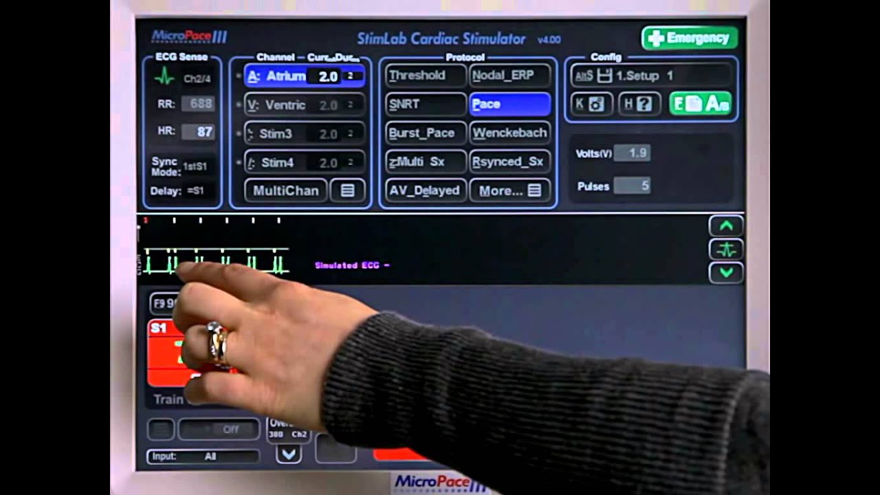 3A - ECG Trigger - Sychronizing to ECG Trig