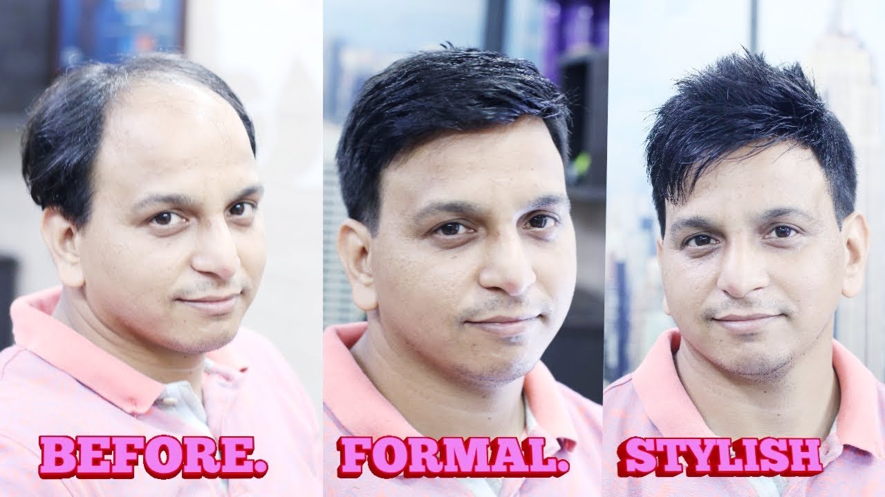 hair patch transformation formal+stylish according face hairstyle by master rizy 9582581323