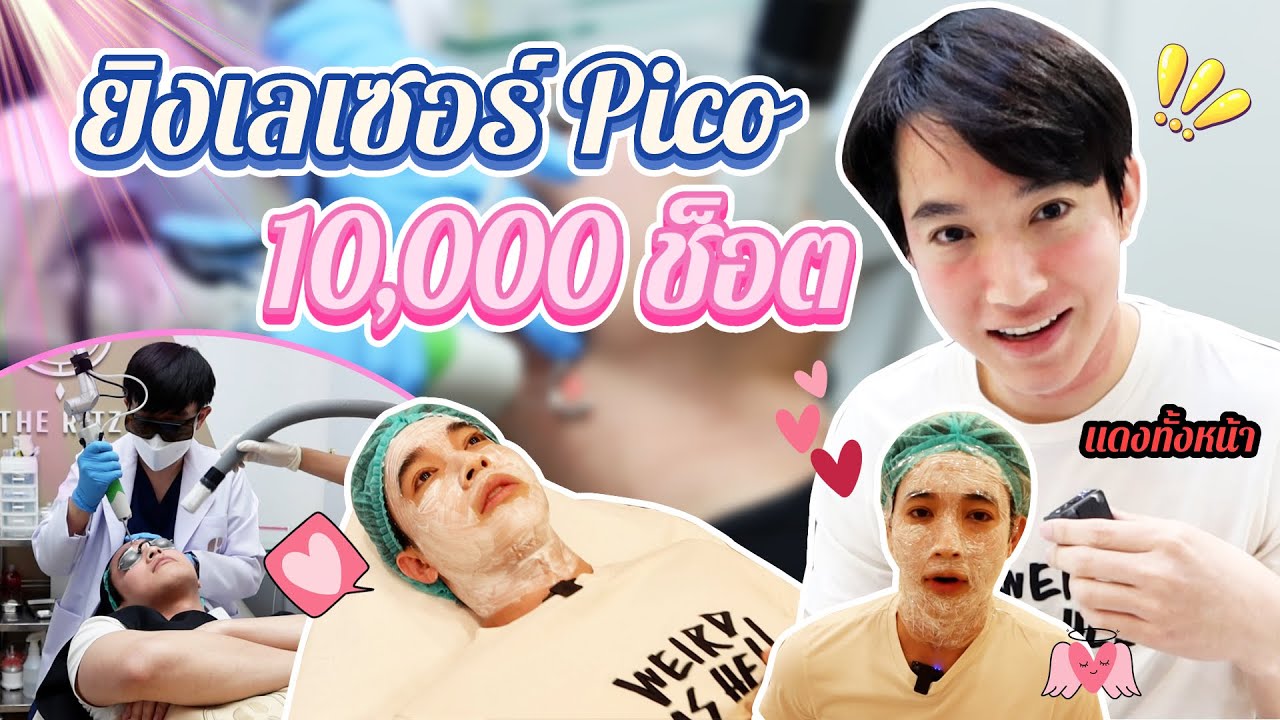 หมอโดนเอง ยิงเลเซอร์ Pico 10,000 ช็อต