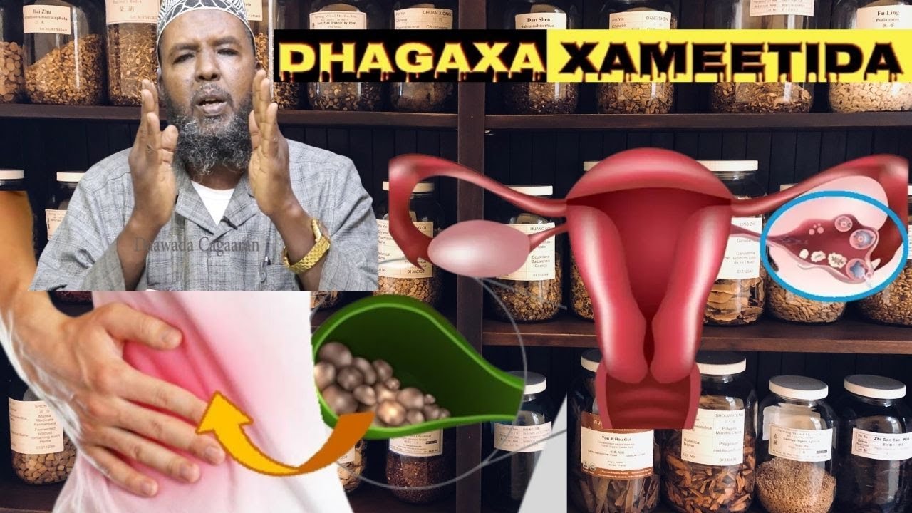 DHAGAXA Xameetida Gala Iyo Buro Biyoodku Daawo Ma Leeyihiin X.Xogwey