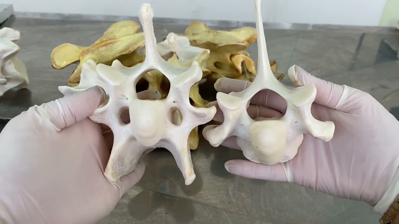 6 7 Cervical Vertebrae