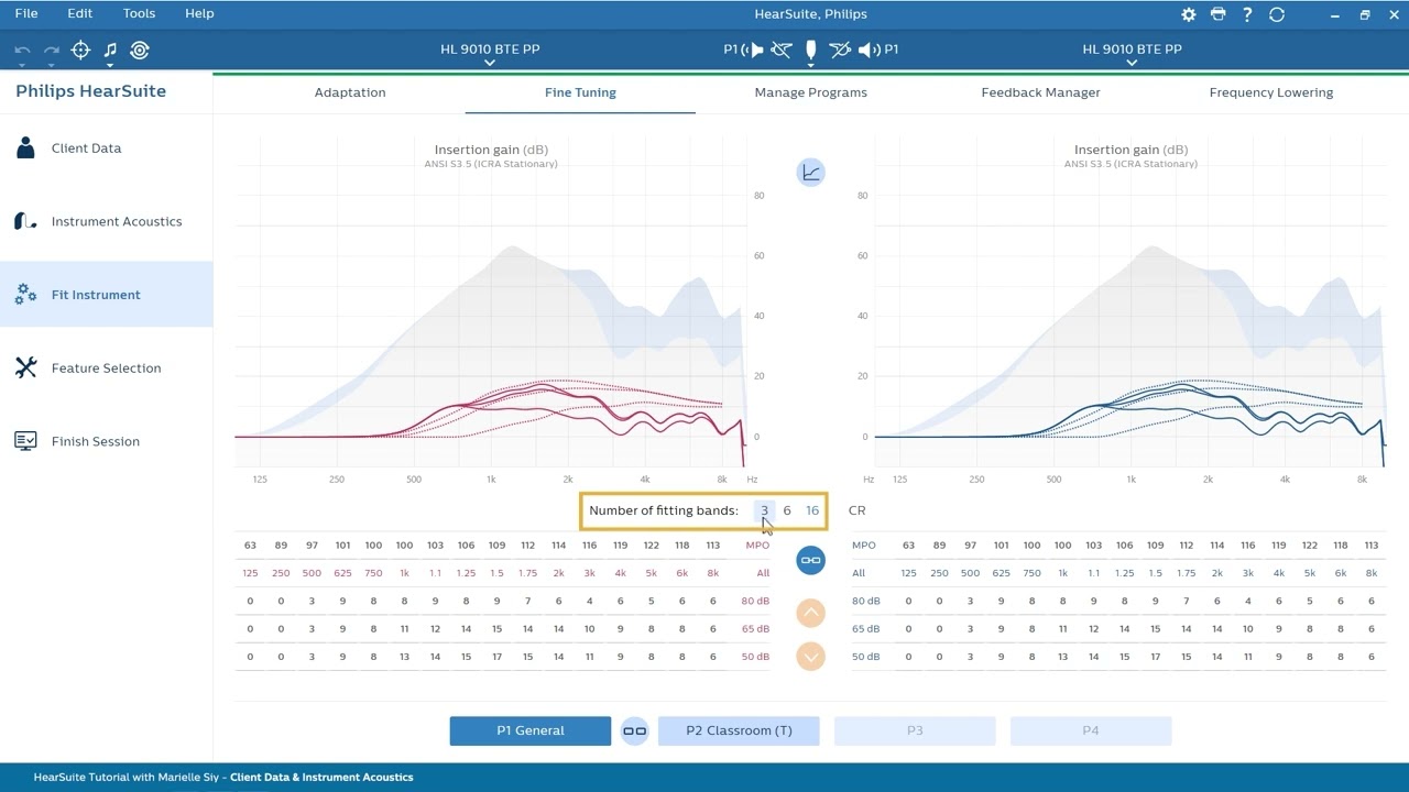 Tutoriel logiciel HearSuite - Adaptation de l'appareil