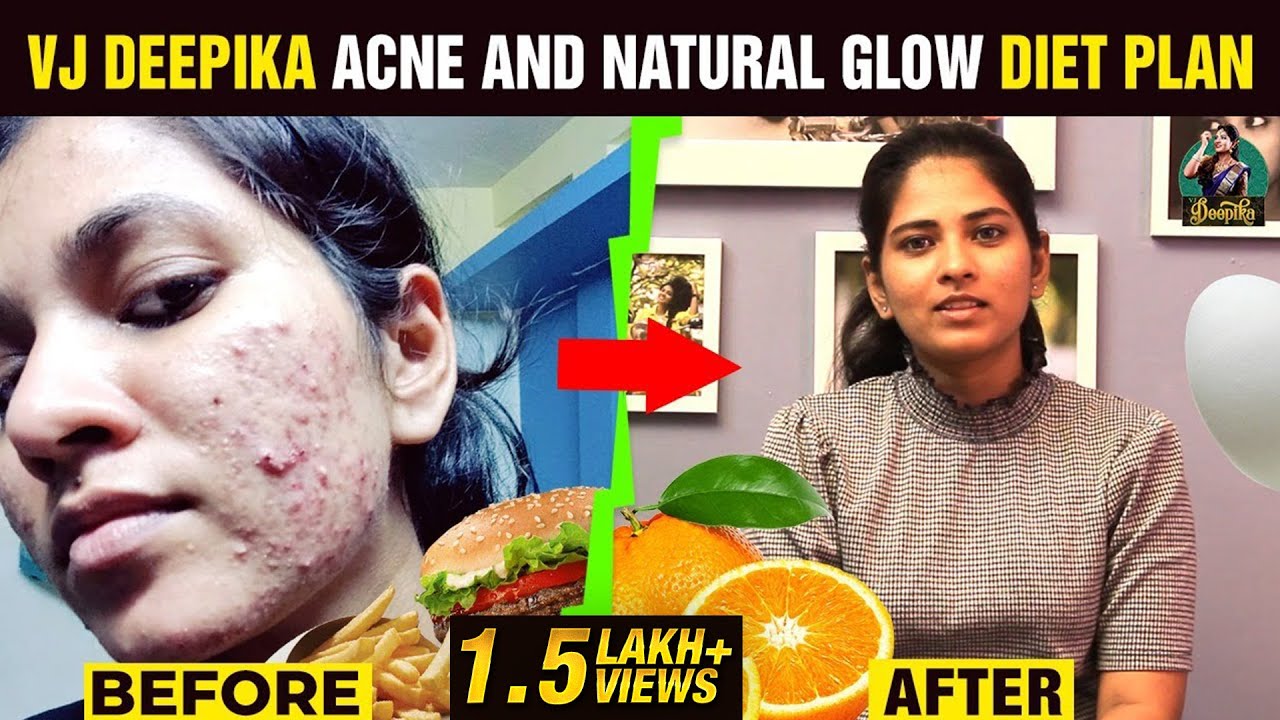 My Diet Plan | Acne and Natural Glow Diet Plan | Diet Routine | VJ Deepika