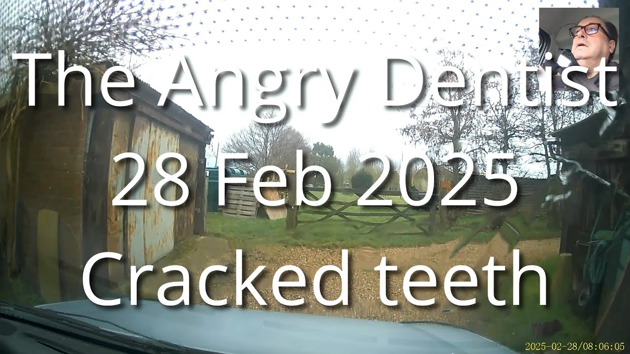 The Angry Dentist&mdash;Cracked Teeth