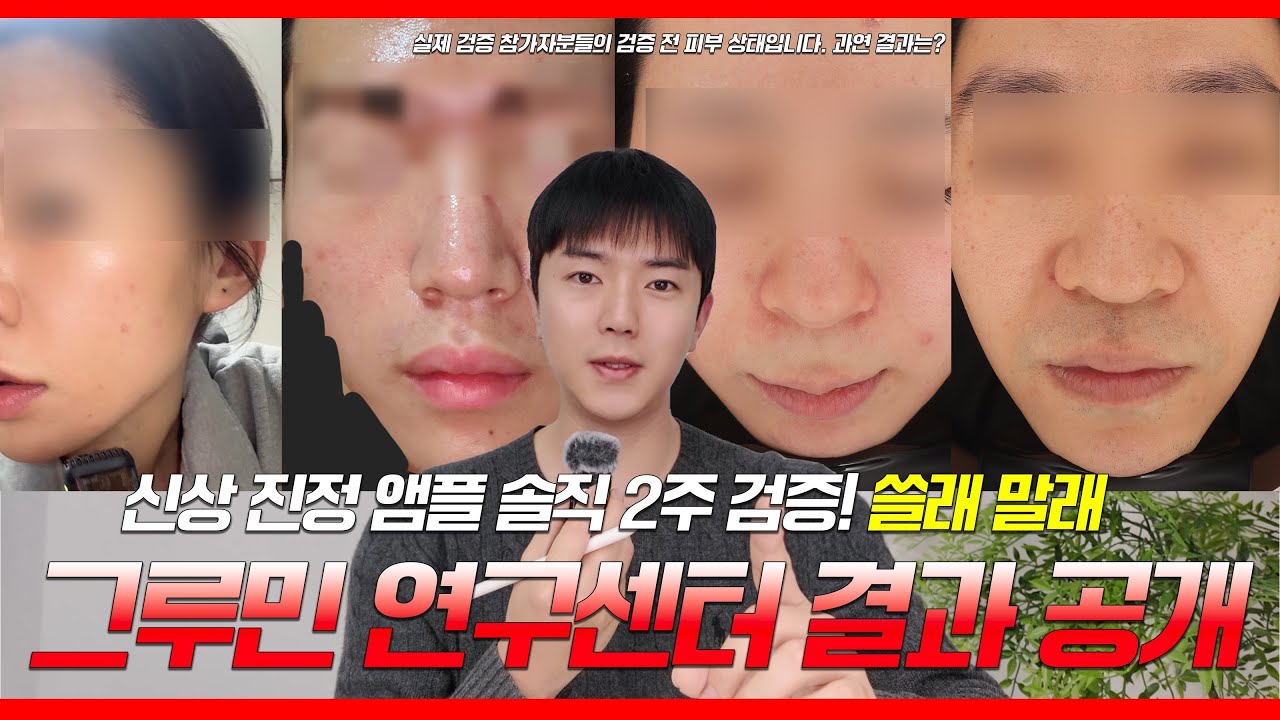 트러블 앰플 추천 | 민감성 피부 2주 검증 결과 공개 | 에이프릴스킨 카밍 앰플