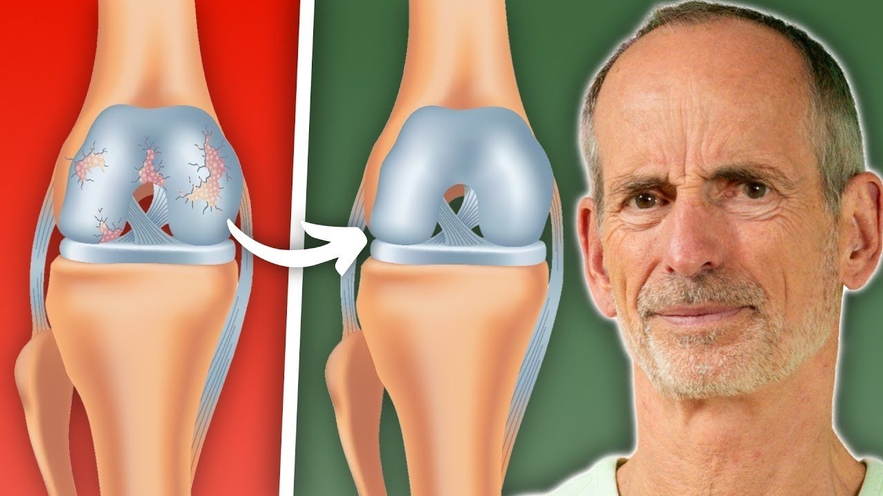 Die WAHRHEIT über Arthrose (niemand sagt dir das)