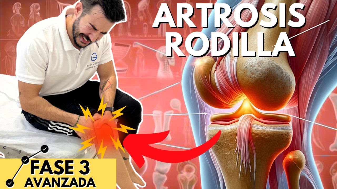 La SOLUCIÓN a la ARTROSIS de RODILLA + ¡REGALO! [FASE 3] 🦵🏼✅