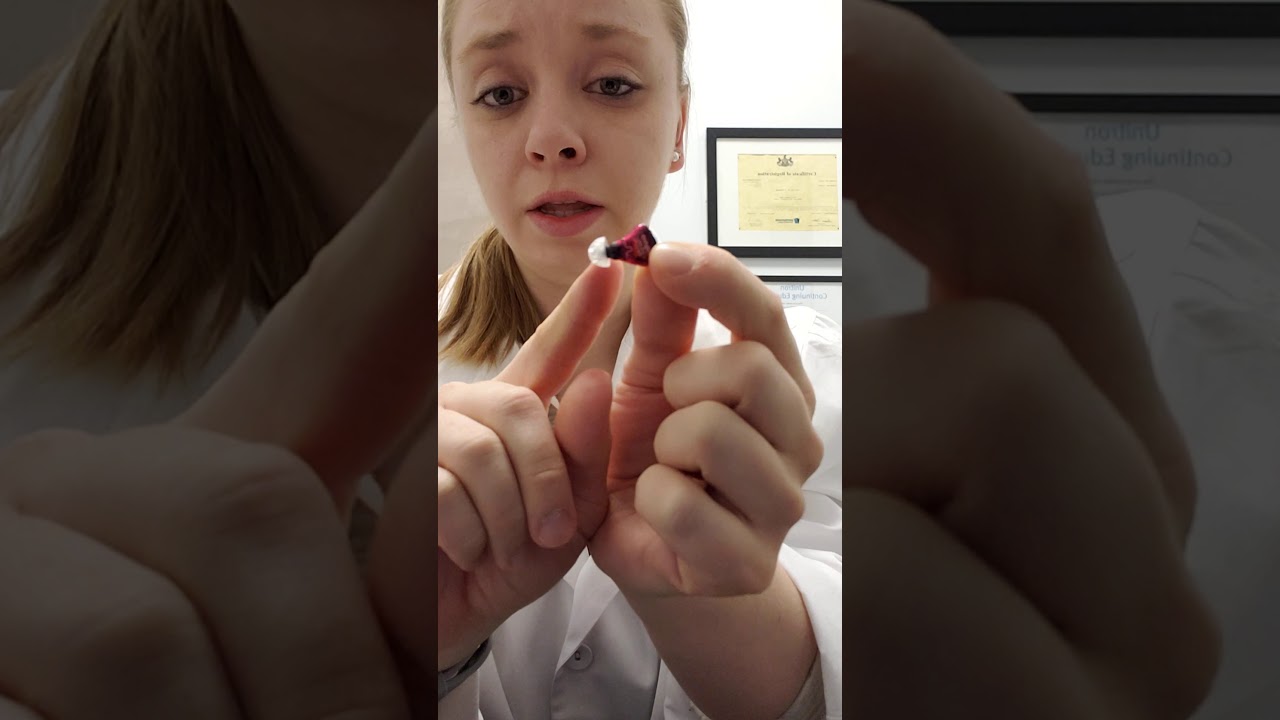 How to Properly Insert In-the-Ear (ITE) Hearing Aids