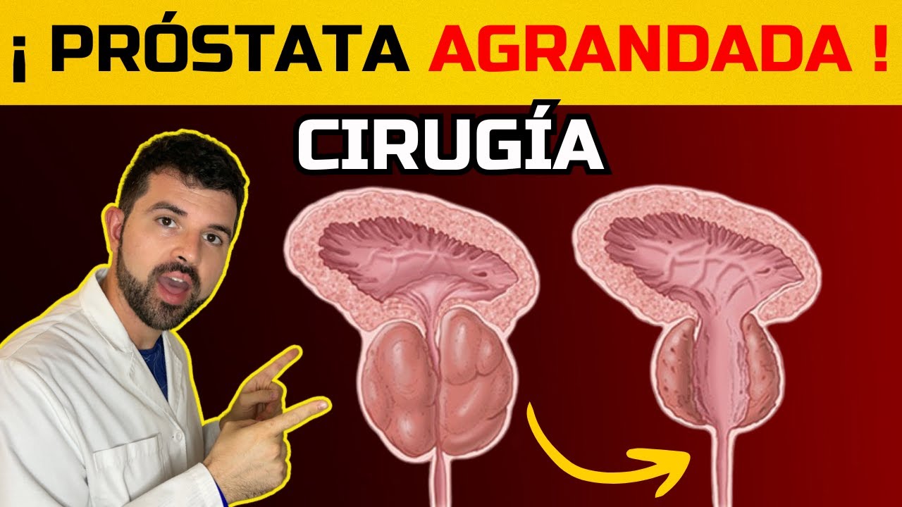 Cirugía RTU de Próstata: Beneficios, Riesgos y Recuperación Explicados
