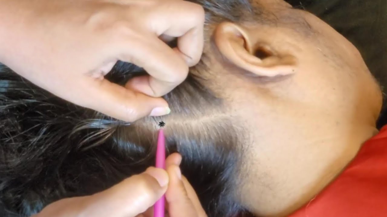 Scalp Check ASMR - Stay Tuned for Sleep
