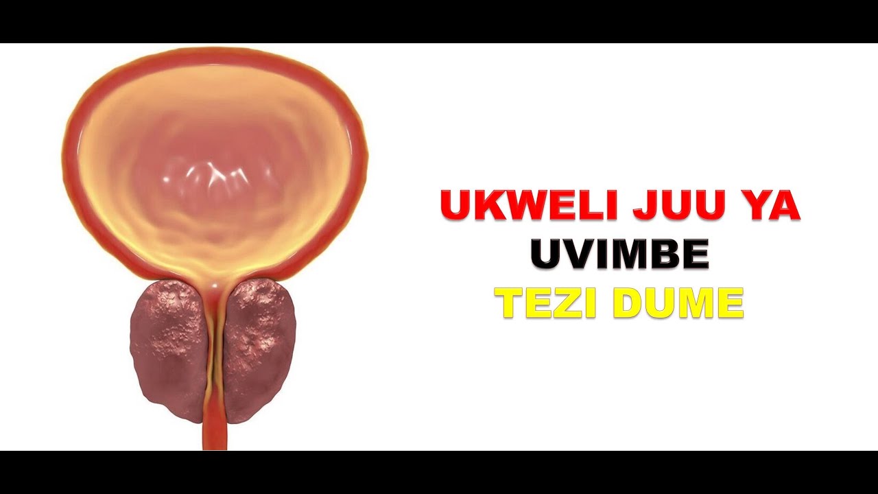 #UKWELI JUU YA UVIMBE WA TEZI DUME | Mittoh Isaac ND,MH