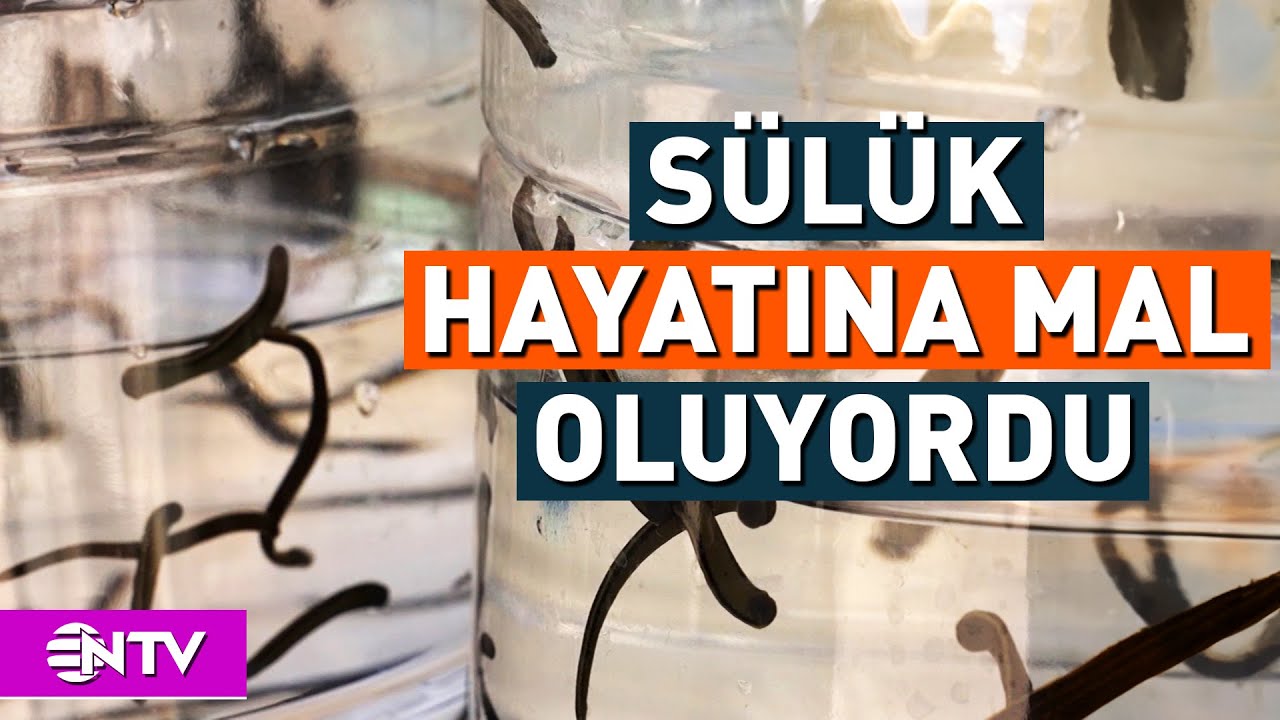 Sülük Tedavisi Yaptırdı Canından Oluyordu | NTV