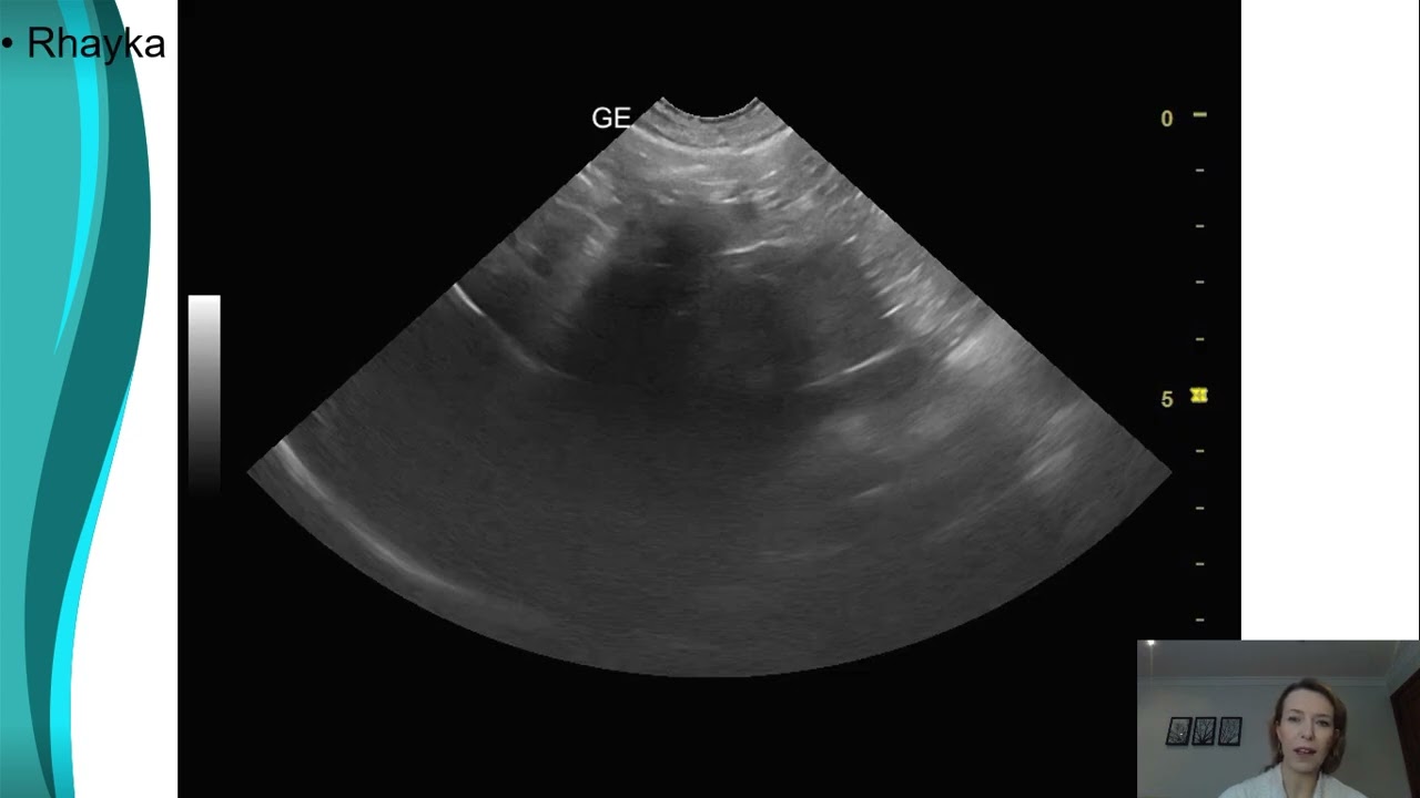 Insulinoma: achados ultrassonográficos no cão