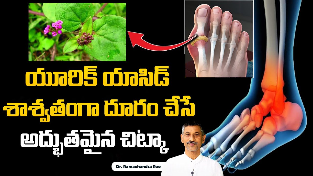 How to Reduce Uric Acid | Osteoporosis | Kidney Damage | Punarnava | Dr. Ramachandra | Hi Tv Health